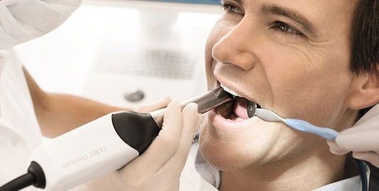 CEREC Wand Being Used on a Patient CEREC Wand Being Used on a Patient