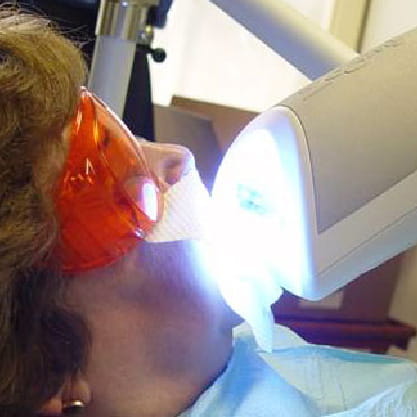 Dr. Tawill DDS - Hi-Tech ZOOM Whitening