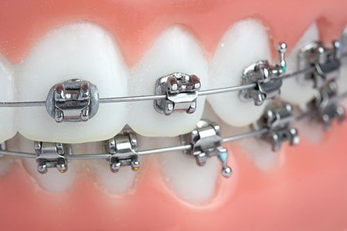 Castro Valley Orthodontist Reginald A. Griggs, D.D.S.