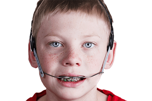 Orthodontic Headgear