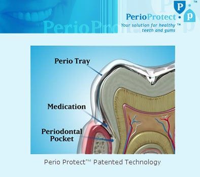 Perio Protect