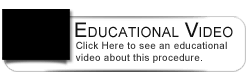 Dental Education Video - Invisalign